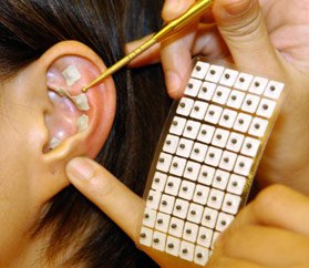 L’art de soigner par l’acupuncture de l’oreille — illustration 2
