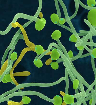 Dépression mentale et candida albicans en médecine chinoise — illustration 1