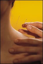 Les scientifiques anglais démontrent la sûreté de l’acupuncture