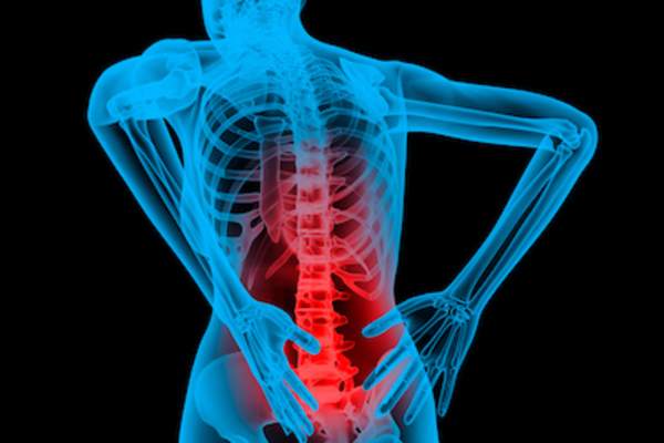 Une spondylarthrite ankylosante contrôlée naturellement